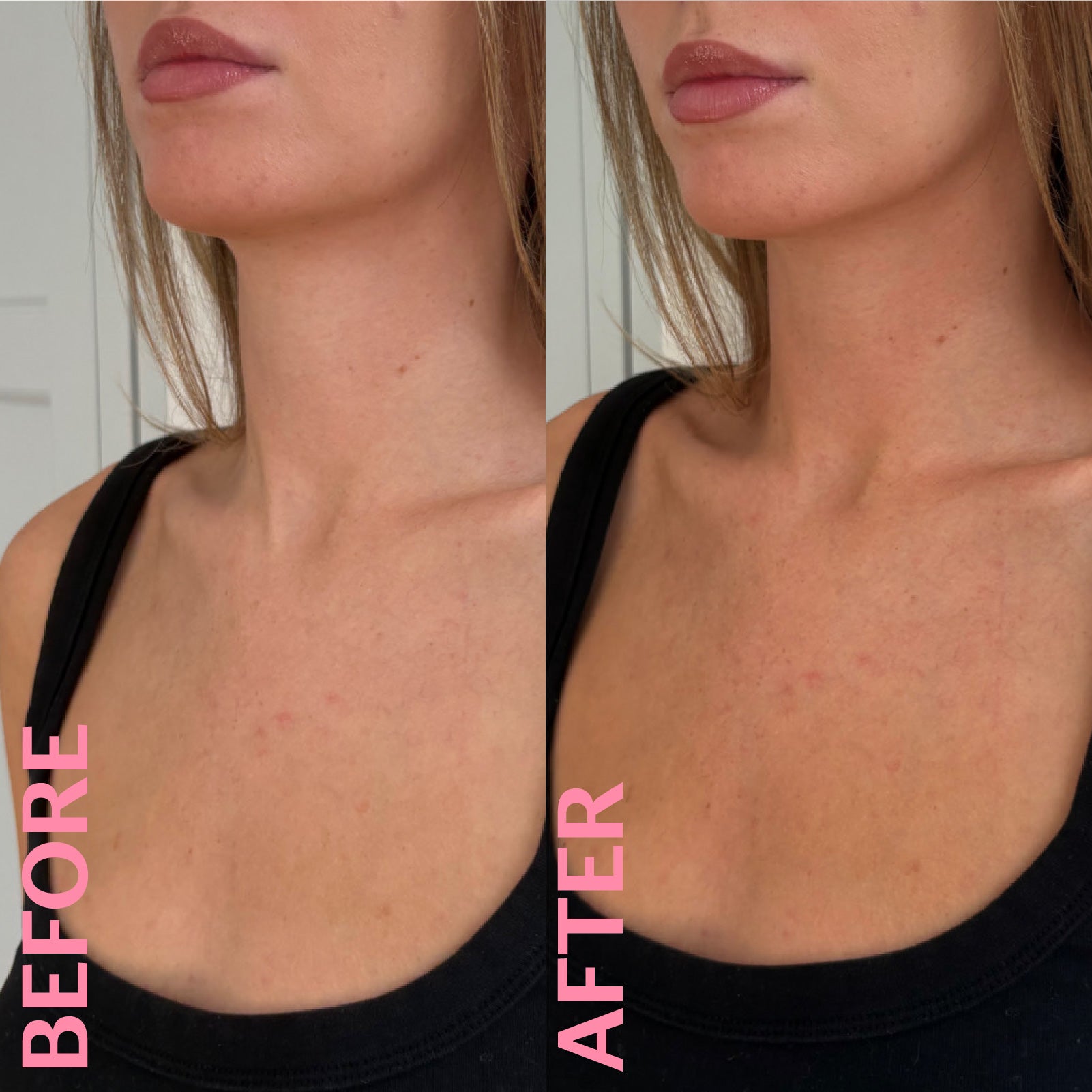 Clear Whipped Tan - Medium Before & After